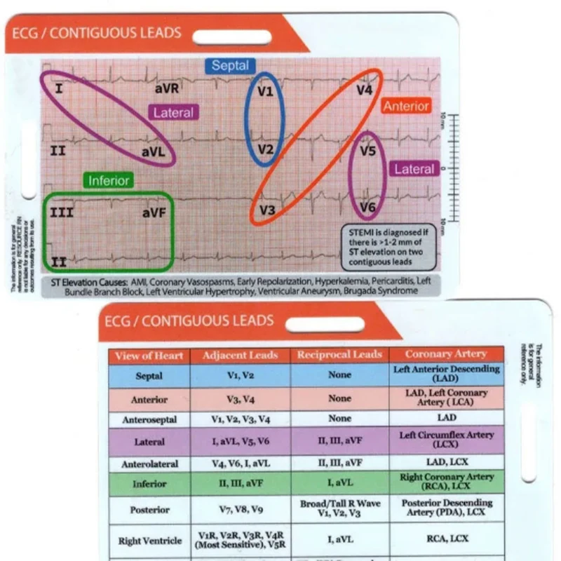 Description Picture 6 of itemNew Ecg/ekg Rhythm Pocket Card Double Sided Design Ekg Rhythm Interpretation Badge Card Ecg Rate Pocket Cards Ekg Calipers 