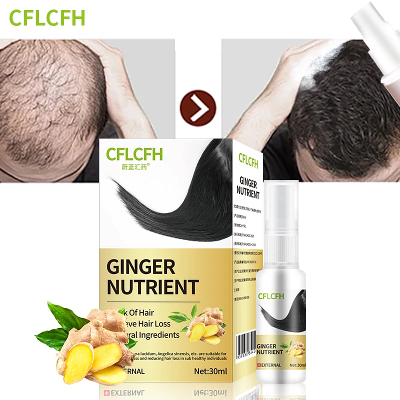 

Hair Growth Spray for Men Women Anti Hair Loss Treatment Care Ginger Ganoderma Lucidum Liquid Scalp Hair Regrowth Products 30ml