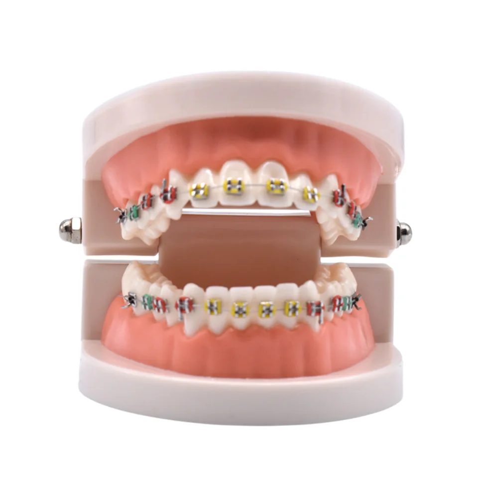 タイポドント、矯正、模型 矯正歯科模型、タイポドント練習、結紮糸結紮、専門技術、トレーニング、指導 - Etsy 歯科診療用タイポドント歯模型（アーチワイヤー、結紮タイ、金属ブラケット、頬側チューブ付き）