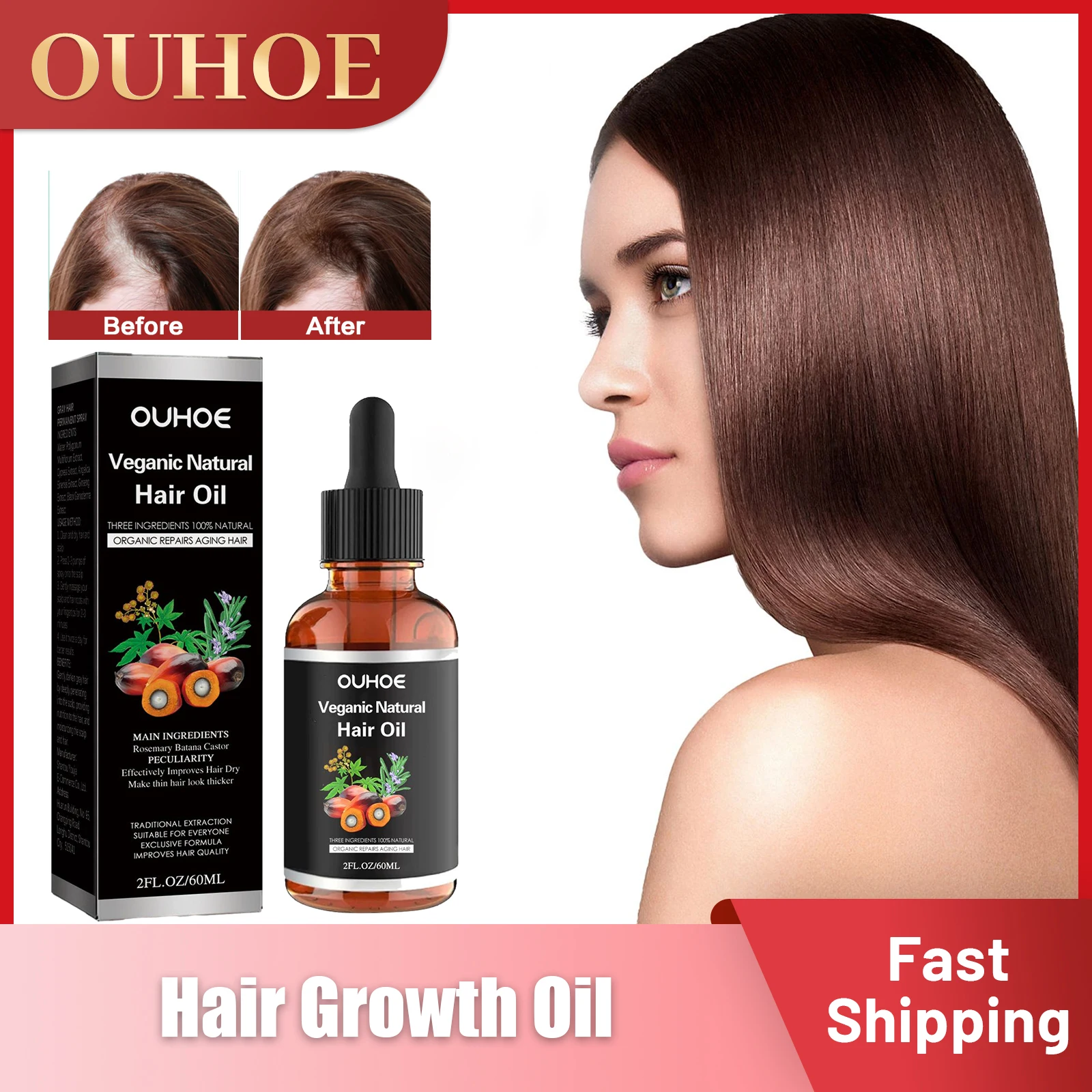 

Veganic Natural Hair Growth Oil Baldness Repair Thinning Scalp Treatment Hereditary Postpartum Seborrheic Anti Hair Loss Serum