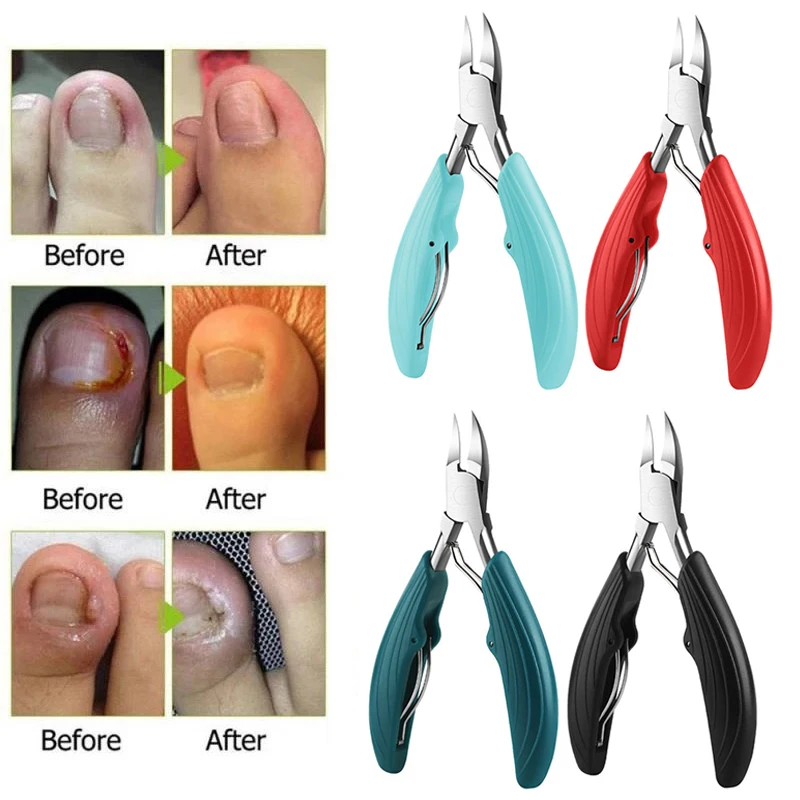 Professional Nail Clipper Ingrown Toenail Podiatry Correction Nippers Cutter Feet Toenail Nipper Tool Paronychia Pedicure Care