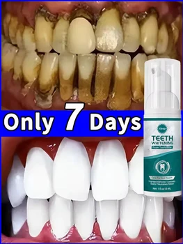 Tartar removers dissolves tartar and eliminates stains