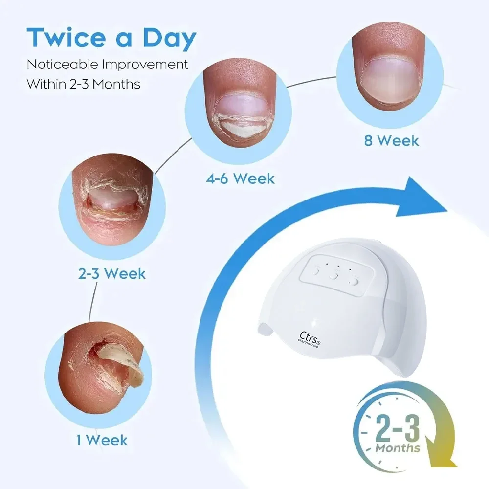 Laser for Nail Fungus Treatment Device Cleaning Onychomycosis Fungal Nail Foot Repair Fungi Nails Removal Anti Mushroom Toenail nail fungus remover,personal health care