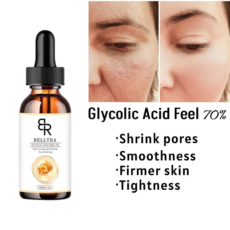 Glycolic Acid Chemical Peel 70% Peeling Acid Smoothes Fine Lines Skin Pigmentation Acne Scar Skin Brighten 30ml