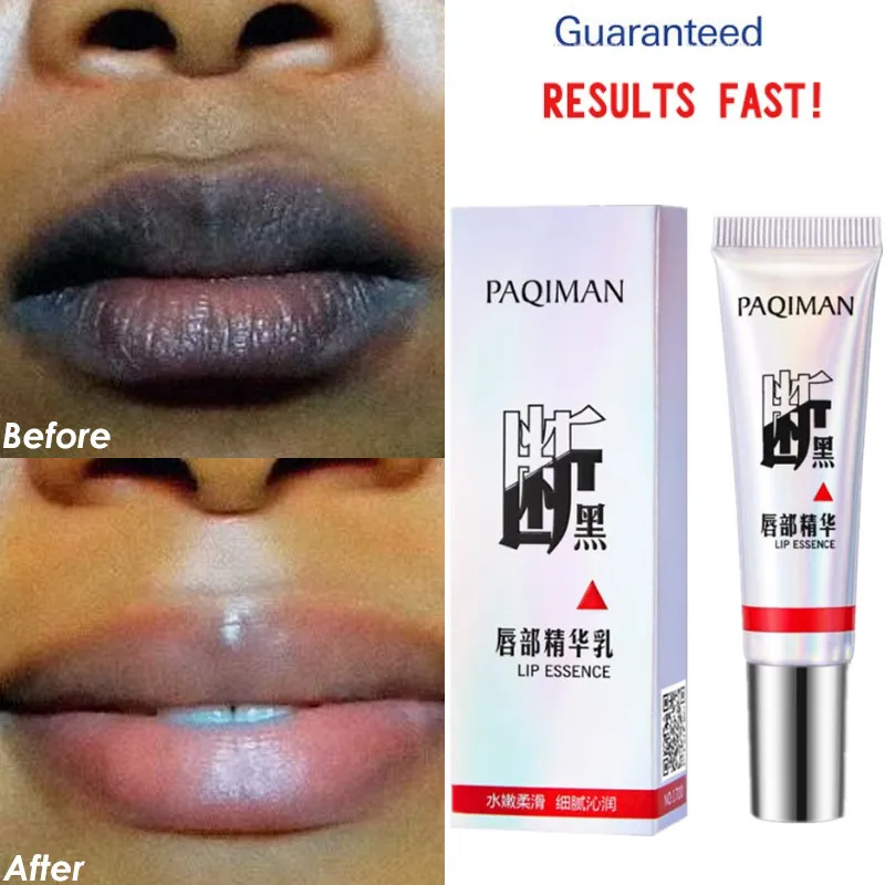 

1PCS Lip care Of Lips Pink Fresh Lightening Bleaching Cream Treatment Remove Dark Smoke Lips lip oil