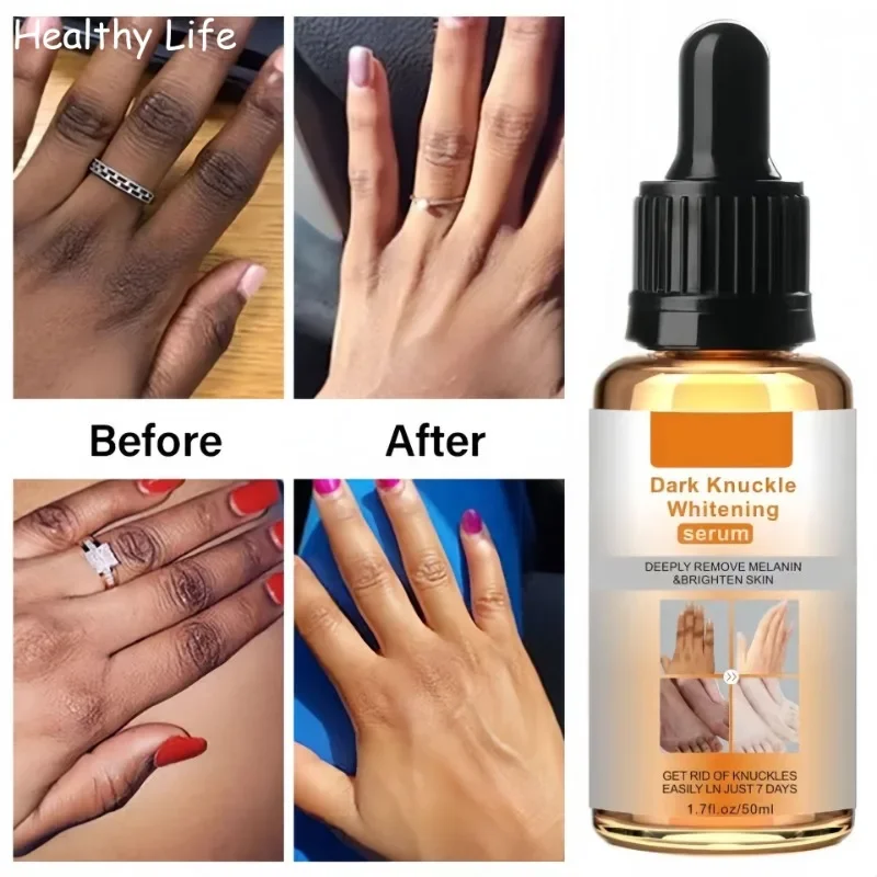 

Whiten Butt Knee Brightening Serum Knuckles Private Parts Underarm Bleaching Essence Remove Melanin Whitening Skin Care Products