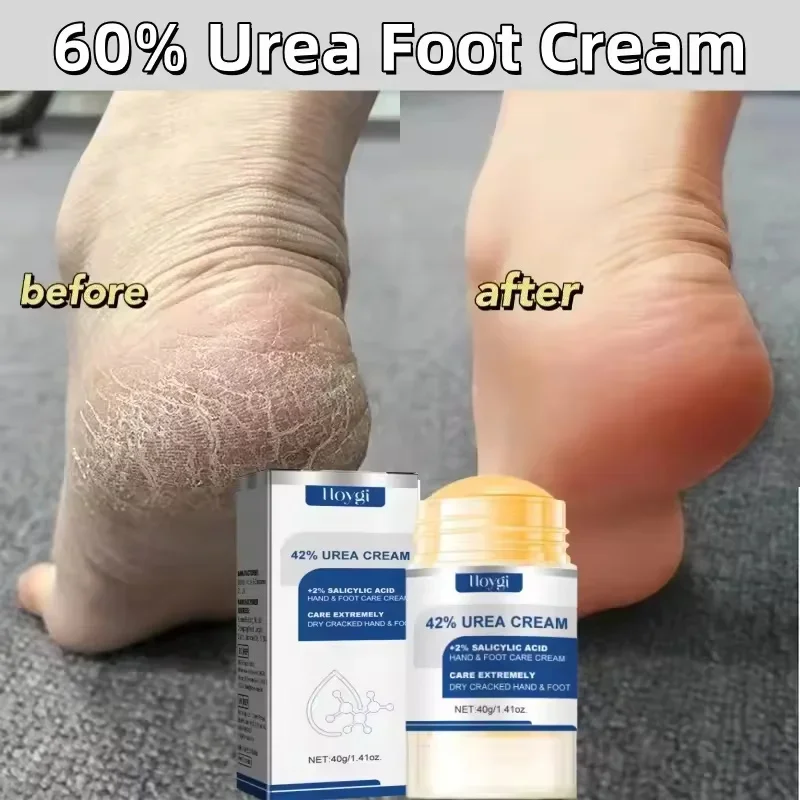 60% Urea Foot Cream Dry Cracked Feet Heel Gentle Exfoliation Softening Skin Ultra-Hydrating Hand Foot Care Cream Stick Protucts