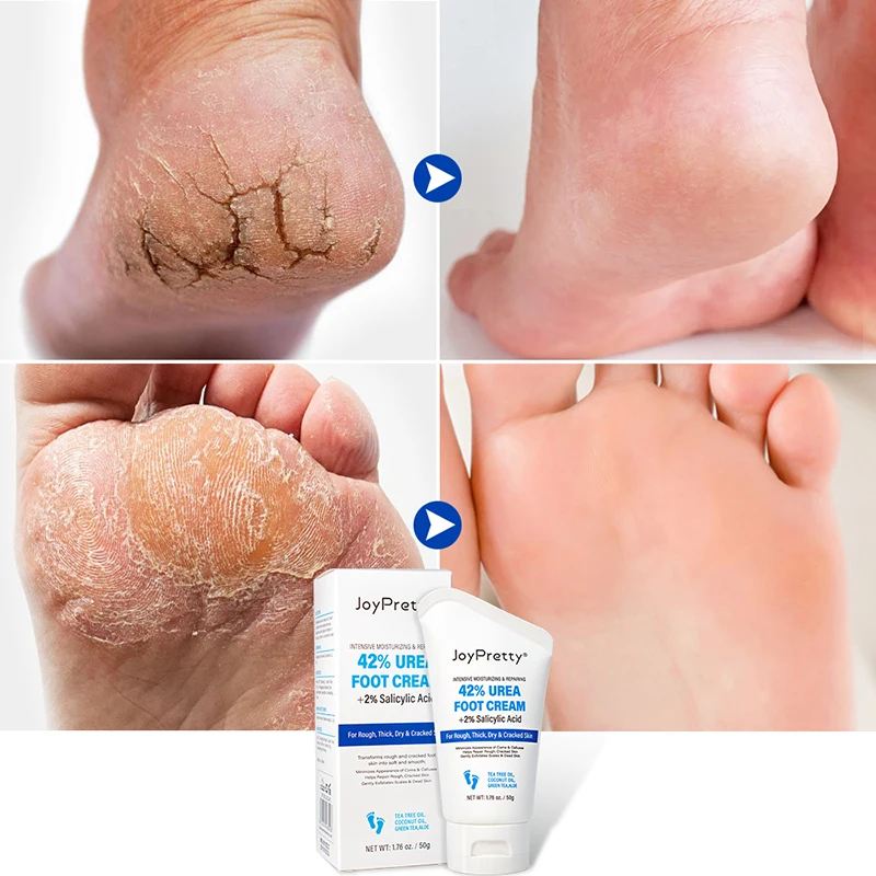 

Moisturizing Hand Feet Skin Care Foot Mask Exfoliator Dead Skin Remover Heel Crack Repair Cream Treatment Autumn And Winter