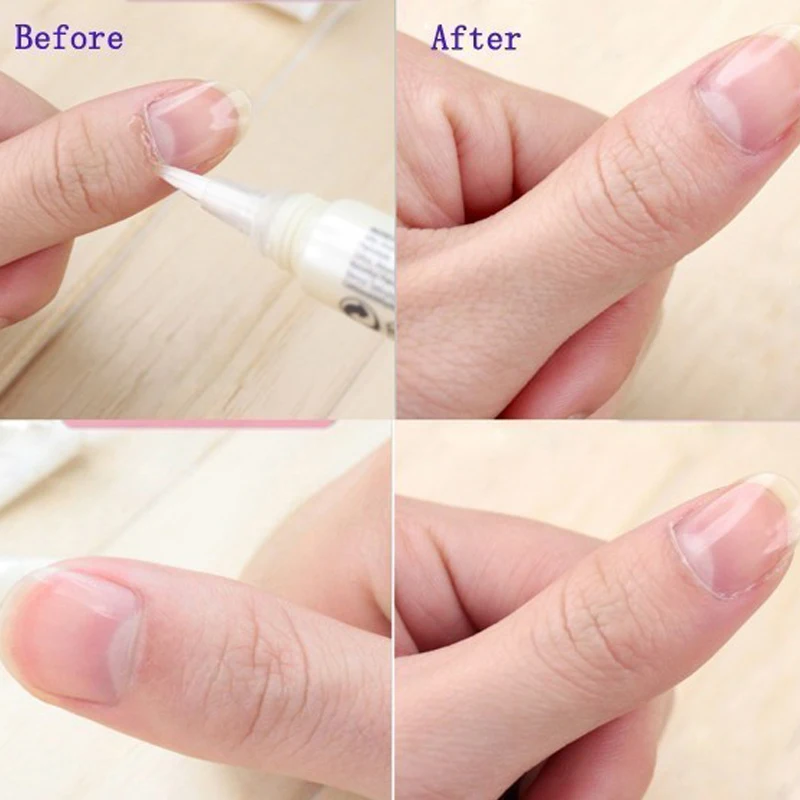 Cuticle Oil Pen Nail Revitalizer Nutrition Oil 30/15PCS 15 Smells Nail Treatment Soften Nourish Manicure Care Product Set nail care oil nail cuticle oil pen nail care kit