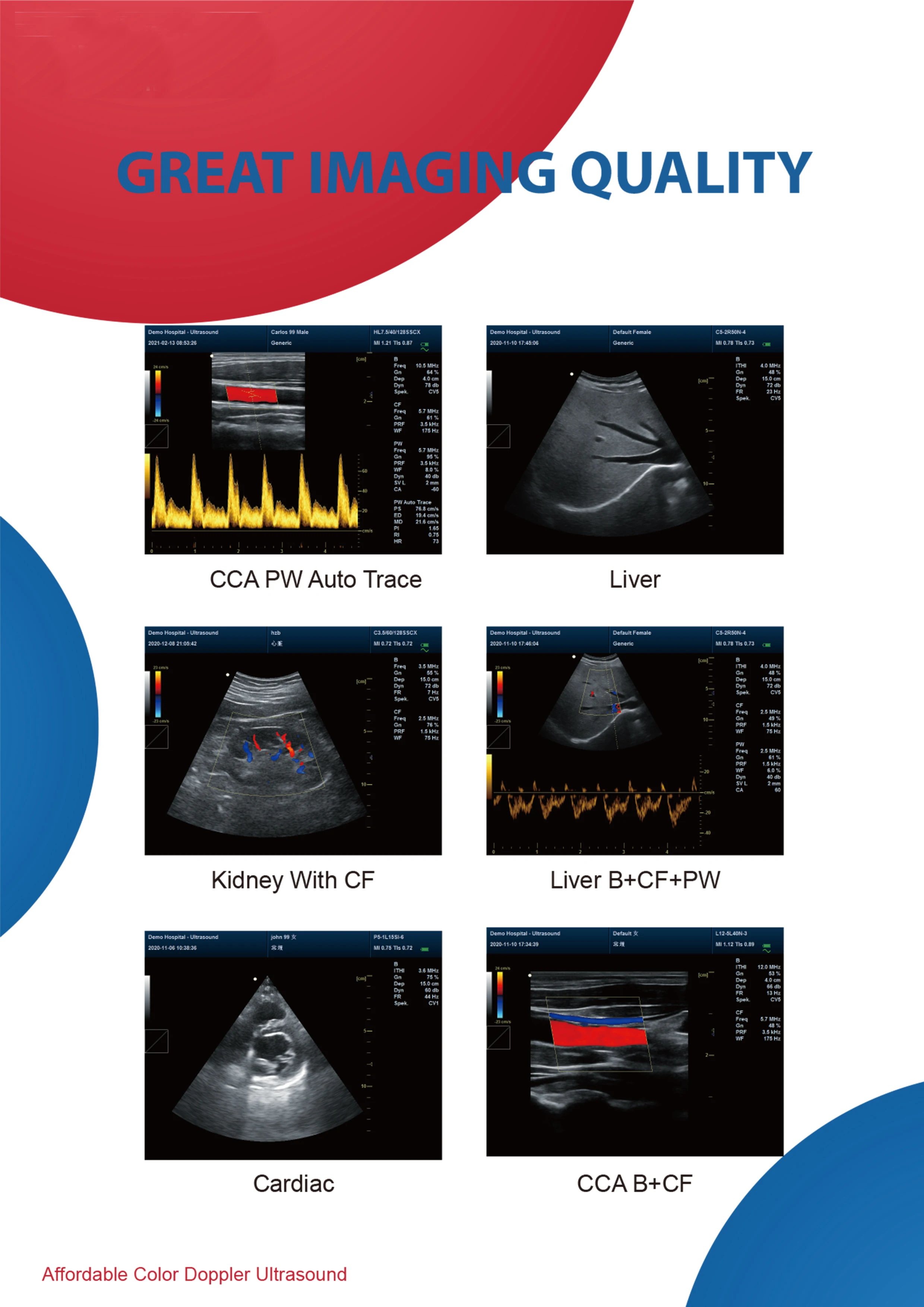 Veterinary Color Doppler Ultrasound Probe Portable Animal Ultrasound Scanner Pro