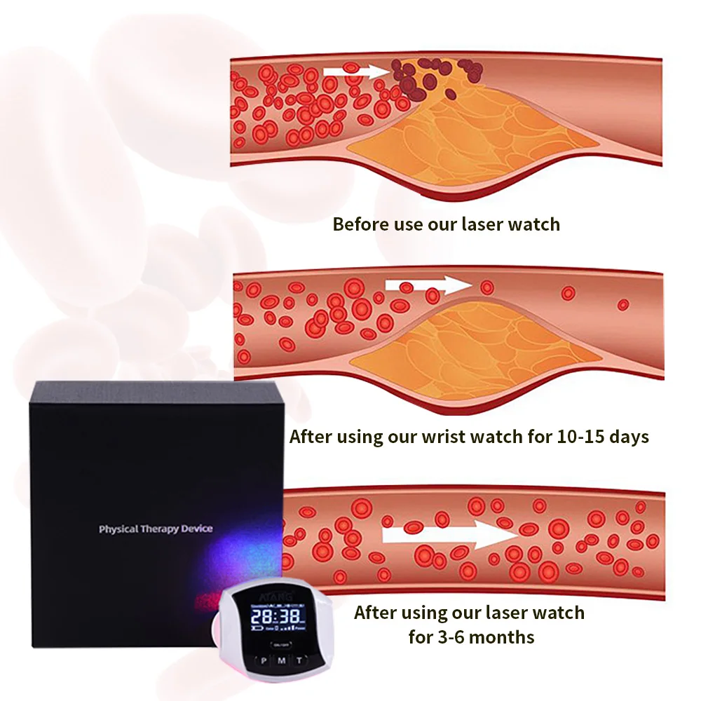 Diabetic Therapy Cold Laser Watch DR Laser Watch Hypertension Face Beauty Blue Yellow Light Treatment Cholesterol lipid