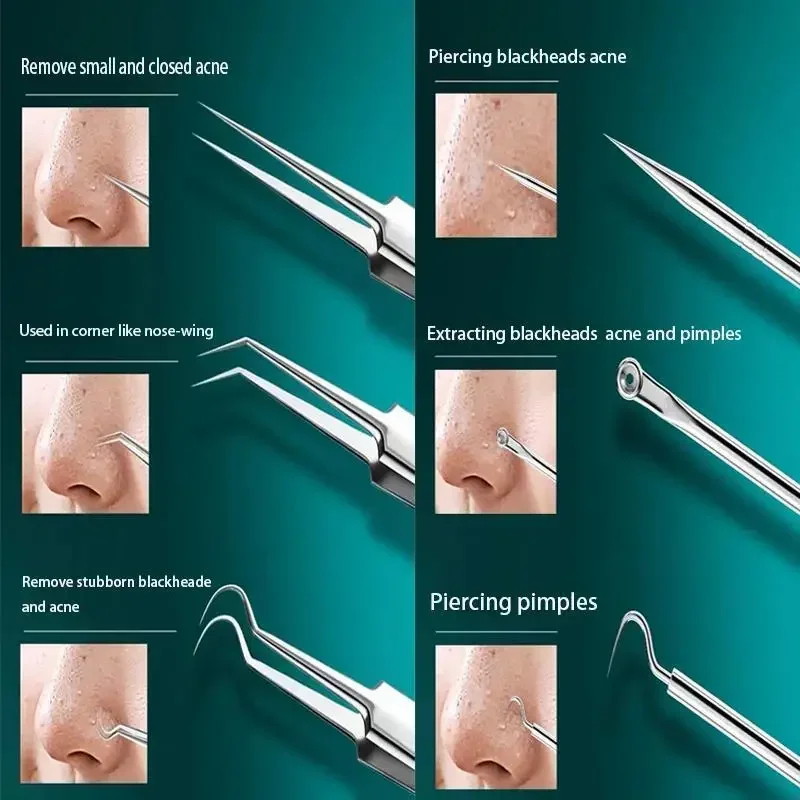 11Pcs Ingrown Hair Tweezers Acne Blackhead Removal Needles