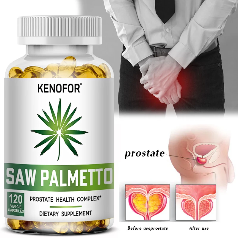 Prostate Saw Palmetto Supplement Men's Prostate Health Support Size Supports Urinary Relief Bladder Control Promotes Hair Growth saw palmetto supplement prostate urinary tract capsules