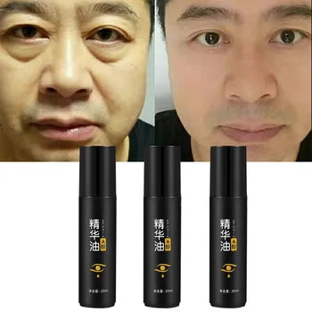 주름 방지 아이 에센스 오일, 안티 에이징 리무버, 다크 서클 아이 케어, 붓기 방지 백 스킨 케어, 도매, 3 개