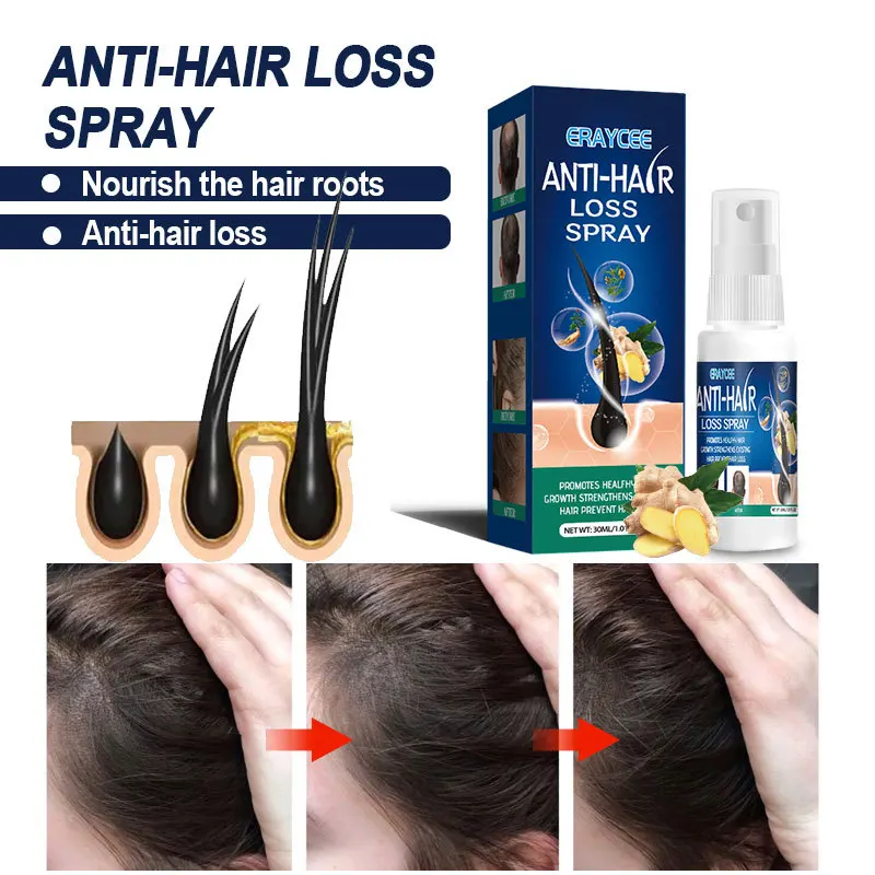ERAYCEE Ginger Hair Growth Spray Products Natural Anti Hair Loss Serum Prevent Baldness Treatment Fast Grows Nourish Damaged Hai
