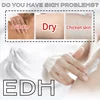 EHD Brighten Skin Tone Moisturizing Body Lotion Refreshing and Non-sticky Prevent Dryness Niacinamide Hydrating Body Lotion 200g 2