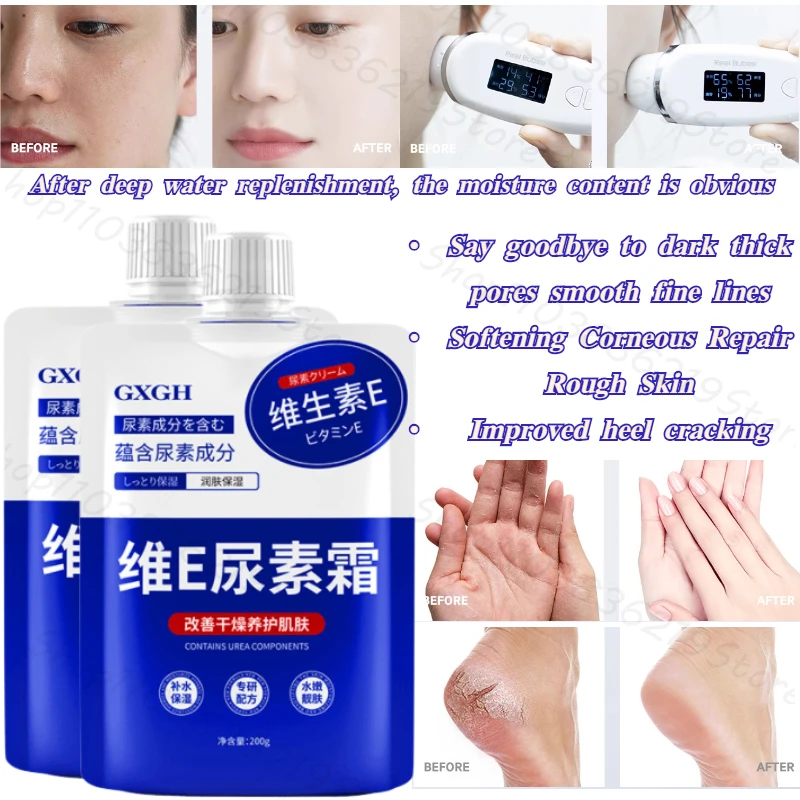 Vitamin E urea cream to improve rough chicken skin deep moisturizing anti-dry body can use moisturizing lotion 200g 2