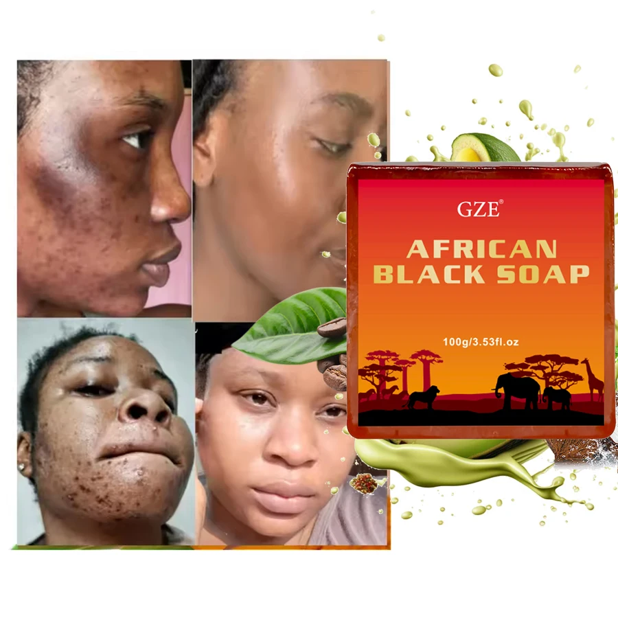 Hand Soap GZE AFRICAN BLACK SOAP with Shea Butter Coconut Oil Kernel Oil for Dry Skin and Skin Conditions Body Wash
