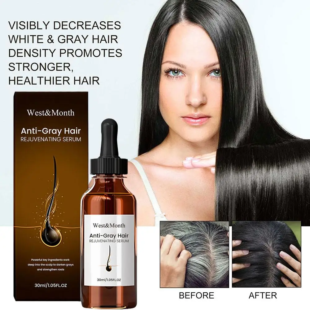 

White Hair Treatment Serum Hair Darkening Essence Hair Liquid Hair Cream Hair Repair Conditioner Anti Loss Hair Regrowth Ca K1P9