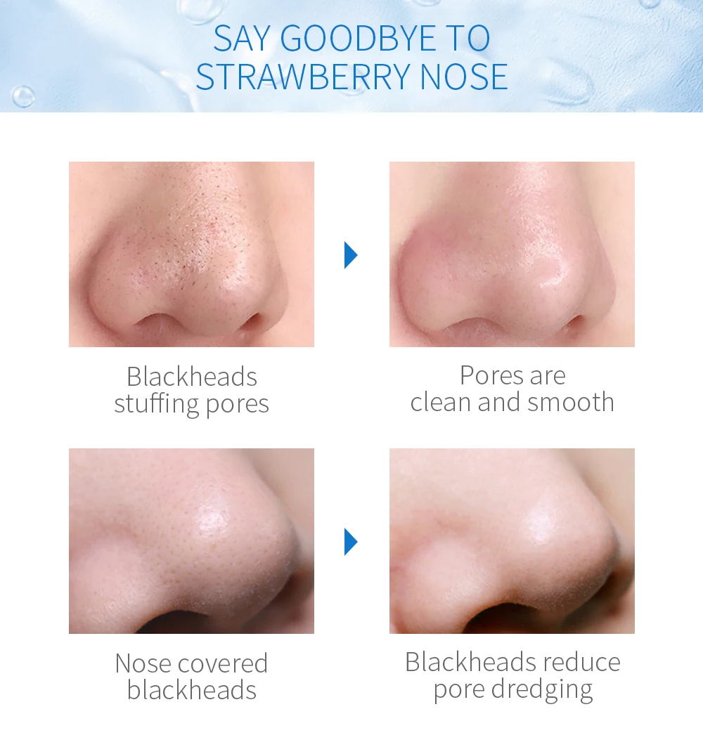 Blackhead Remover Facial Pore Cleanser Blackhead Remover Pore Vacuum Face Cleaner Nose Face Deep Cleansing Skin Care Device