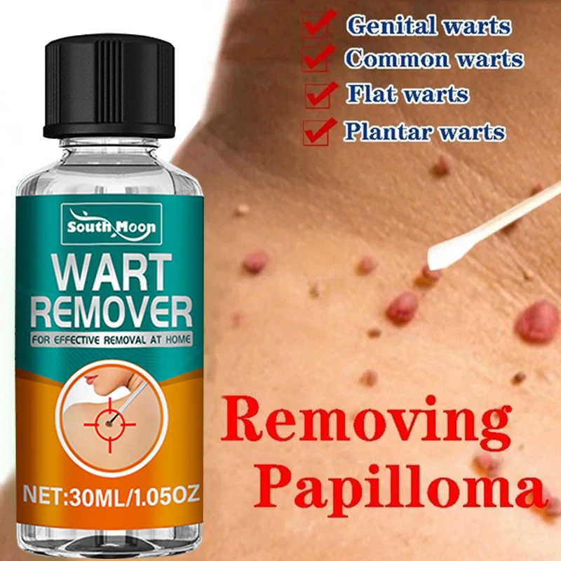 Natural Wart Remover Skin Tags Solutions Serum Remove Mole Foot Corns