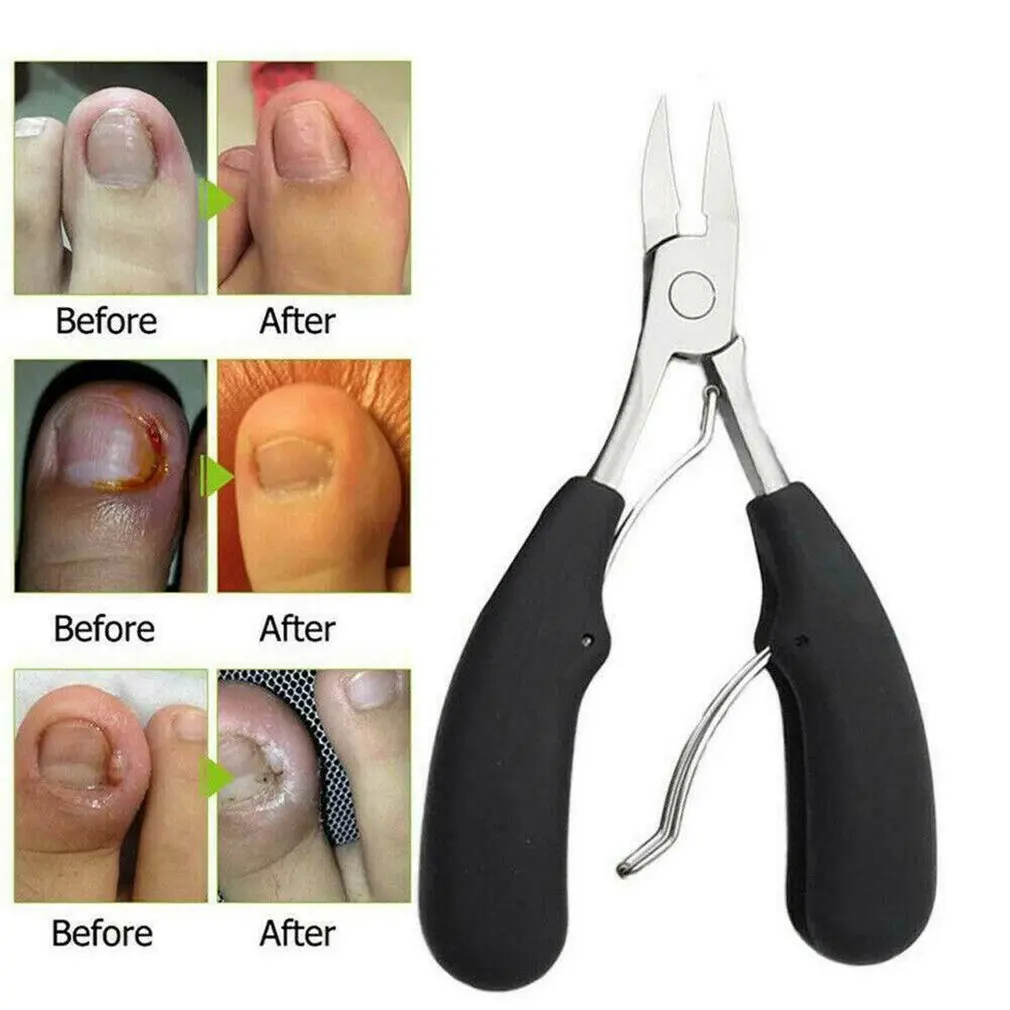 Amazon.com: TEAORB Podiatrist Ingrown Toenail Clippers, Toe Nail Clippers  for Thick Nail & Ingrown Toenails, Professional Stainless Steel Toenails  Trimmer, Sharp Curved Blade, Pedicure Tool for Adults & Seniors : Beauty &