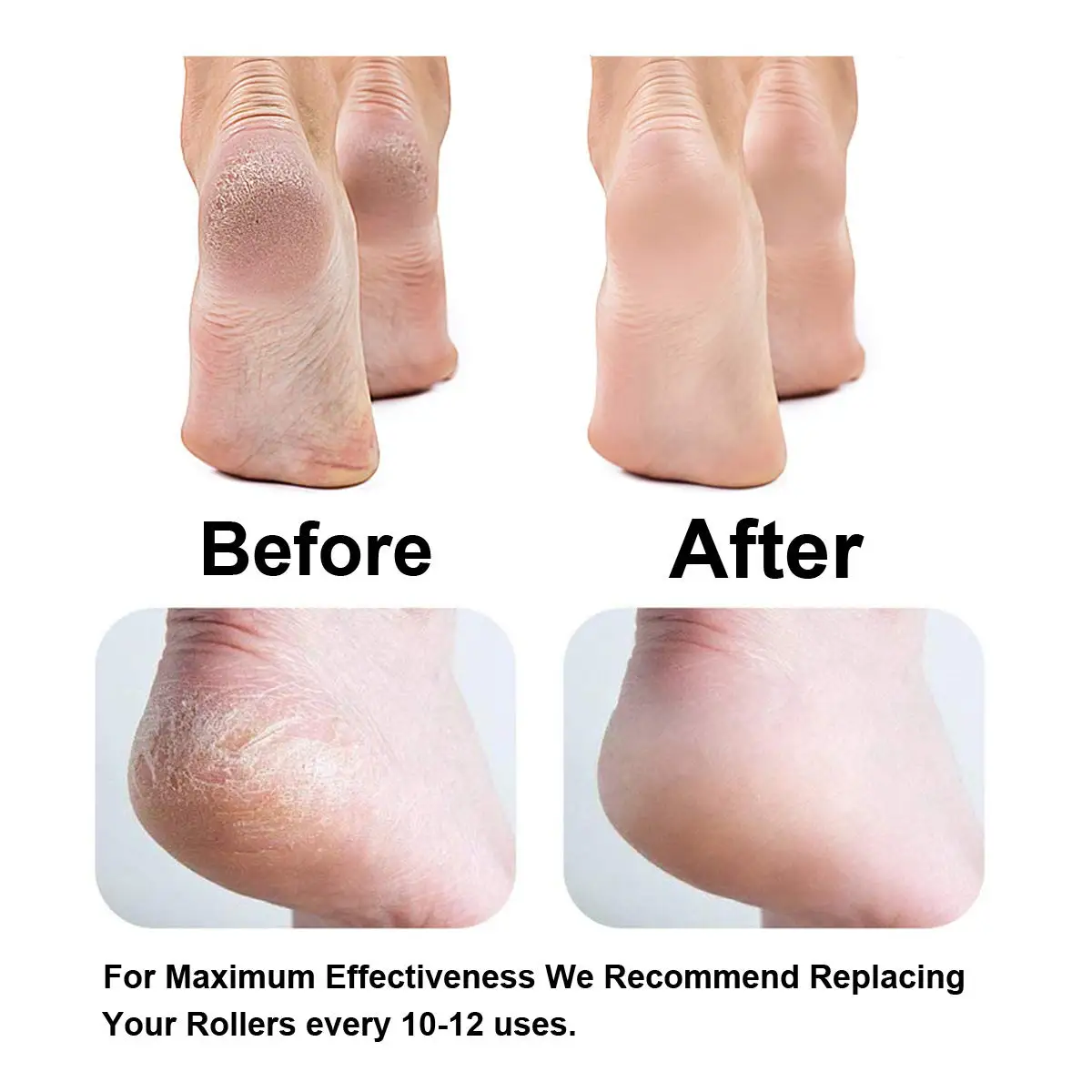 Foot Care Tool Heads Pedi Hard Skin Remover Refills Replacement Rollers For File Foot Care Tool 6