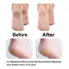 Foot Care Tool Heads Pedi Hard Skin Remover Refills Replacement Rollers For File Foot Care Tool 6
