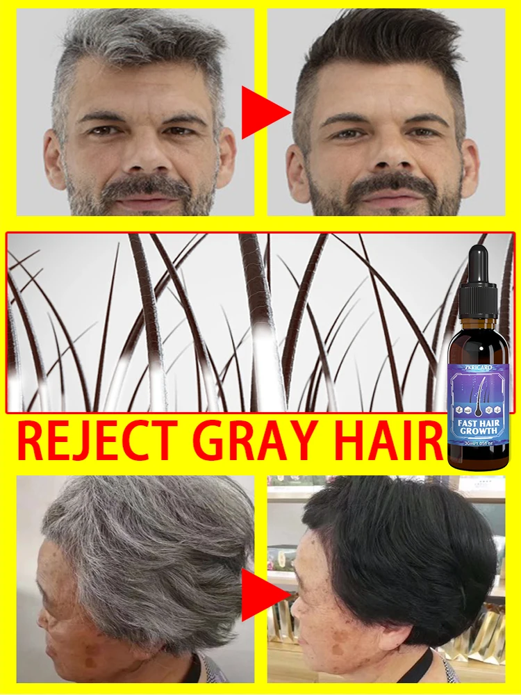 Hair color restorer turn white hair into black hair remove gray hair in 7 days restore natural healthy hair color