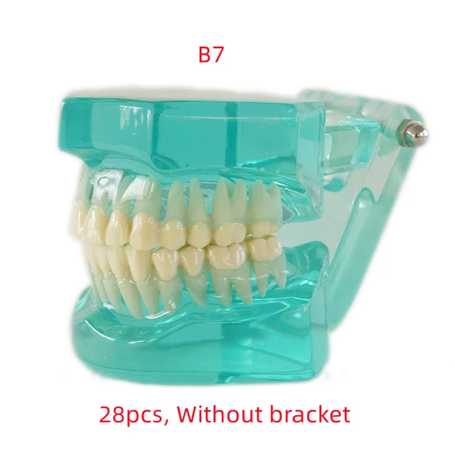 Orthodontics Model with Ceramic and Metal Brackets Teach Model