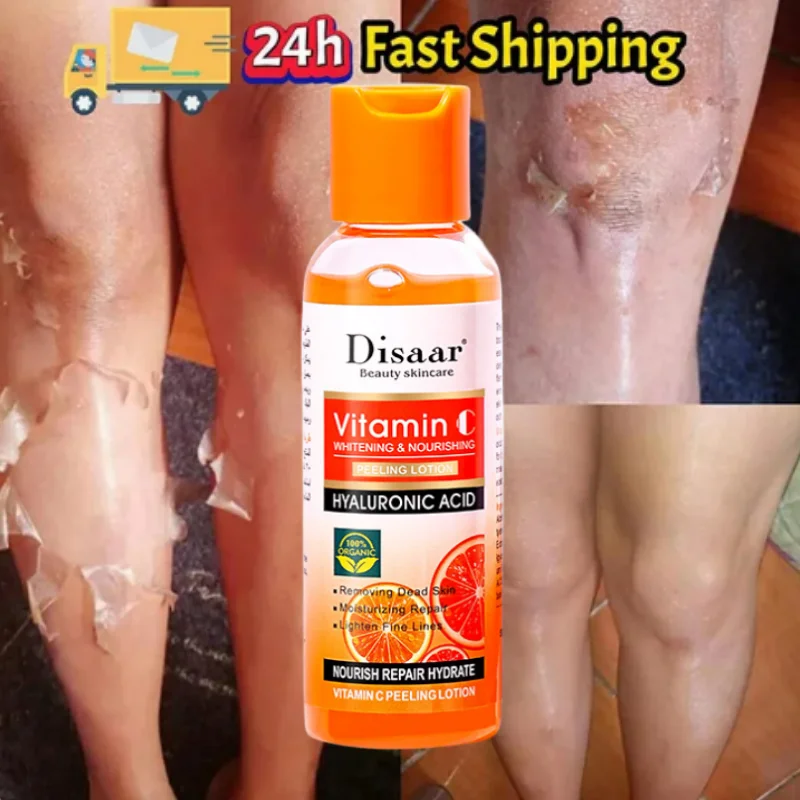 

Yellow Peeling Lotion Oil 100% Organic Bleaching Dark Skin Exfoliating Whitening Nourishing Blackhead Acid Moisturiz Body Scrub