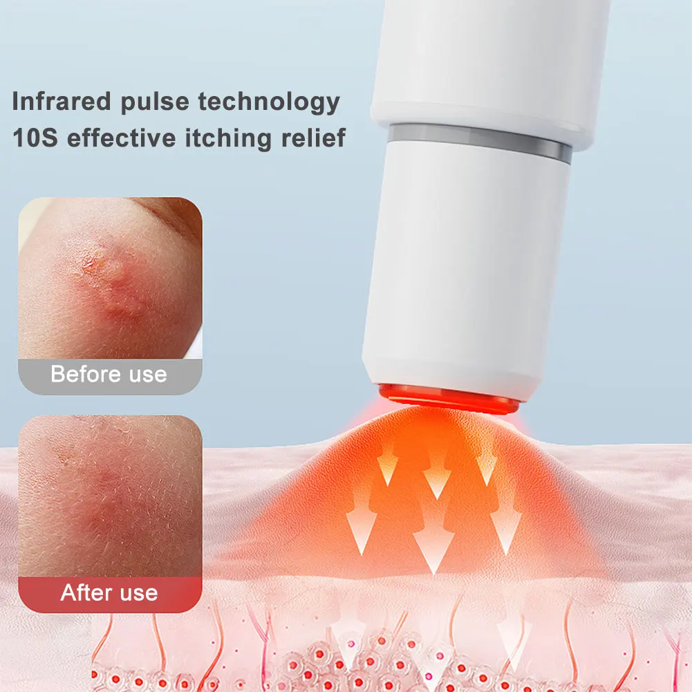 Electronic Mosquito Bite Pen 5