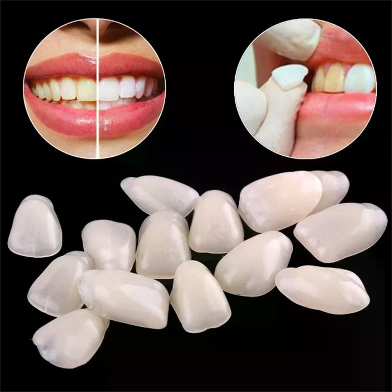 Faccette Dentali Temporanee per Sbiancamento, Membrane Dentali con Faccette Sbiancanti Ultra Sottili in Resina per Denti Anteriori - immagine 2