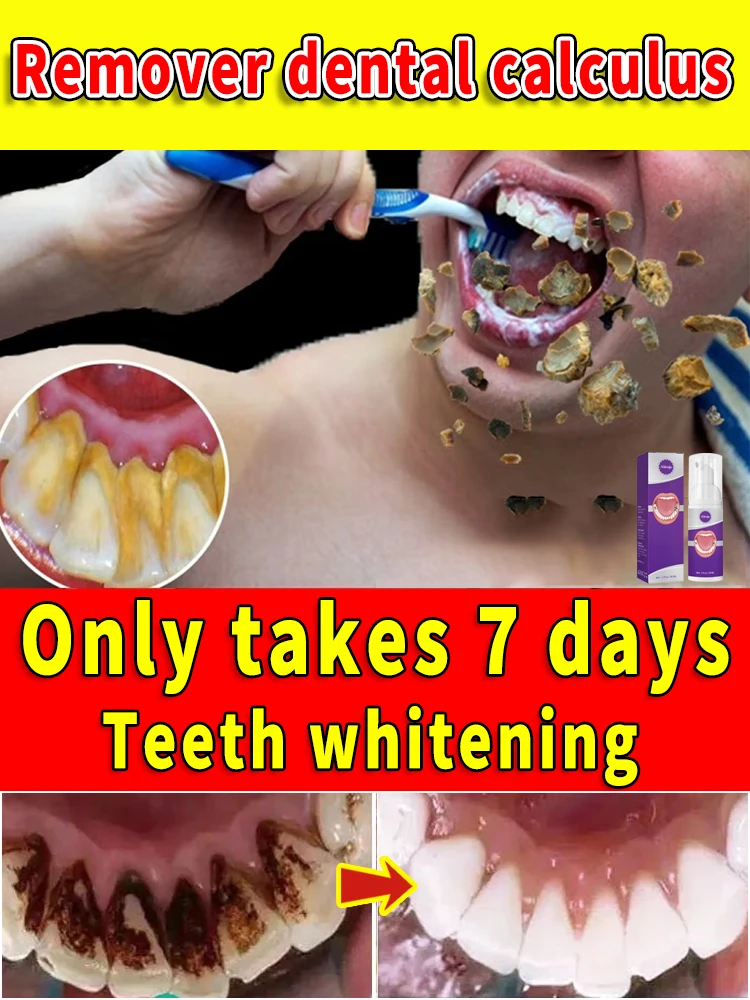 

Стоматологический аппарат для удаления косточек