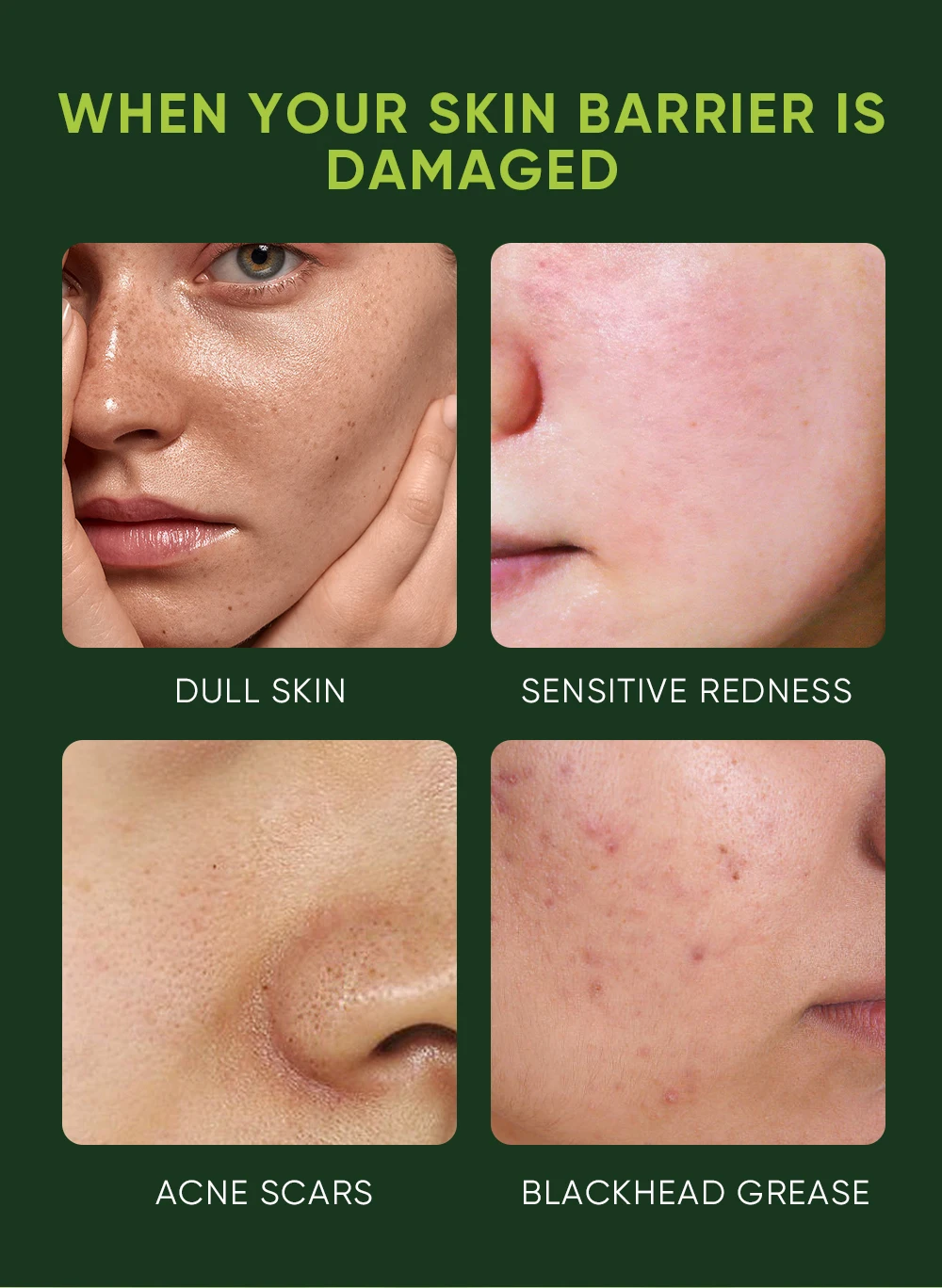 Looking for Licorice Root Extract Essential Oil Antiacnes Licorice