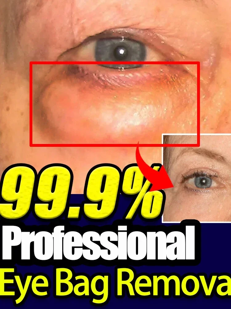 Magic 7 Days Anti-Wrinkle Anti-Dark Circles Anti-puffiness Eye Bags Fat Particles Anti-Aging Lifting Firming Eye Cream For Women Men