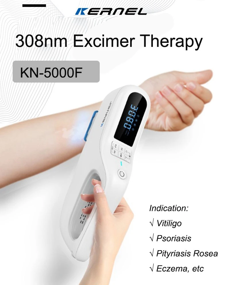 

KN-5000F high power focused xenon chloride handheld XeCl Excimer 308nm laser vitiligo light terapy treatment device for home use