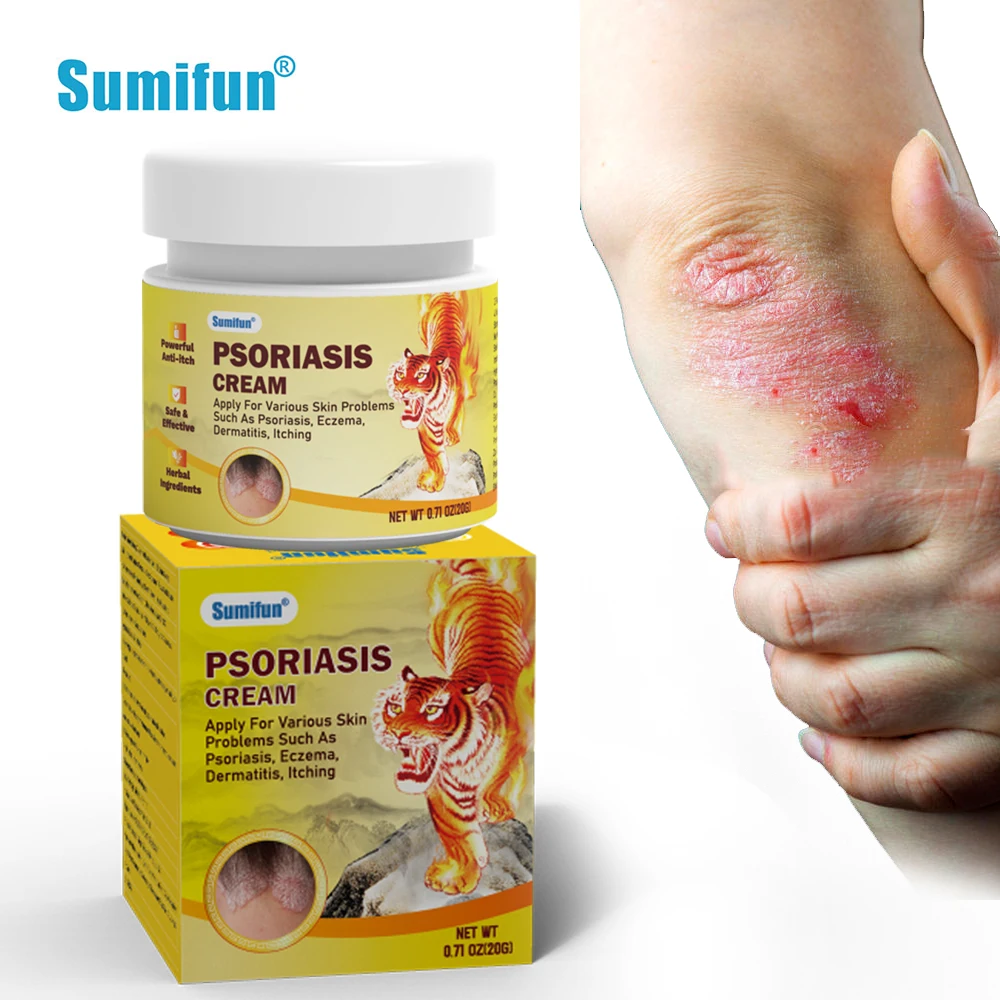 Sumifun Psoriasis Cream Dermatitis Eczematoid Treatment Antibacterial Ointment 20g