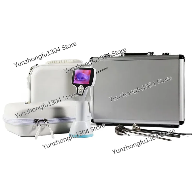 

HD светильник источник эндоскопа цифровой видео отоскоп для обследования и диагностики Ent