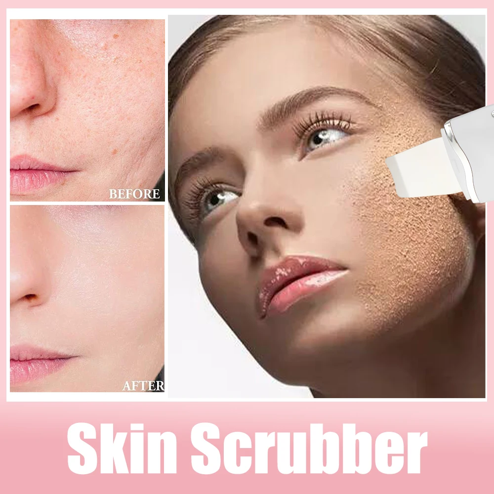 Deep Cleaning Electric Skin Scrubber Blackhead Remover Facial Shovel Cleanser