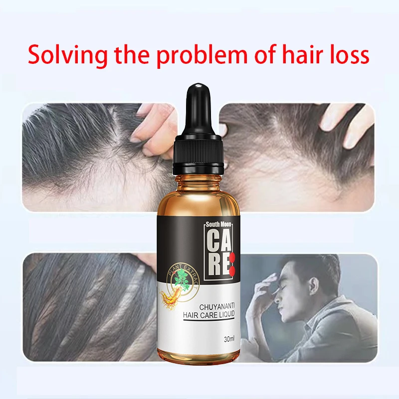 

Hair care and anti hair loss essence nourishes hair roots, promotes black hair, oily hair, and is suitable for both men and wome