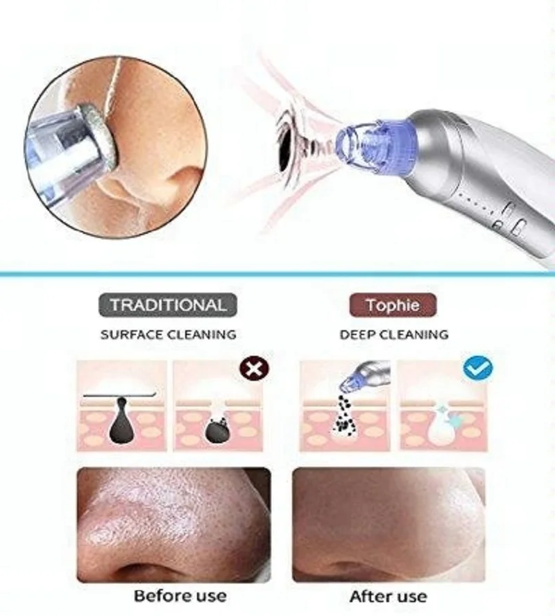 Blackhead Remover Vacuum Pore Cleaner Comedo Microdermabrasion Face Pore Cleaning Blackhead Suction Machine USB Rechargeable