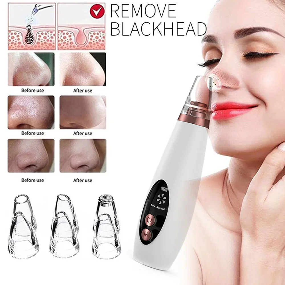 Blackhead Remover Acne Remover Facial Pore Cleanser Electric Blackhead Remover Vacuum Pore Cleaning Facial Black Spots White Dot Pimple Acne Cleaner Face Care Tool Beauty