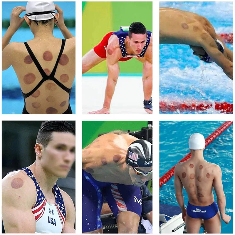 full set of vacuum cups displayed