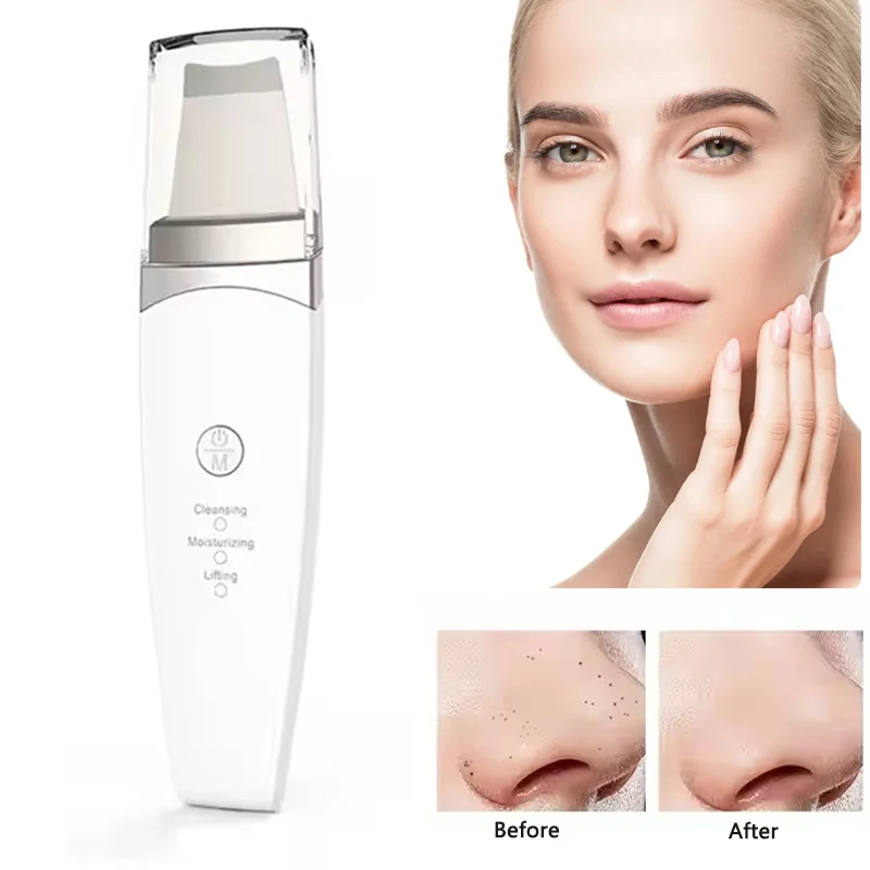 Ultrasonic Skin Scrubber Facial Spatula Blackhead Remover Deep Face Cleaning Skin Lift Machine Peeling Shovel Pore Cleaner