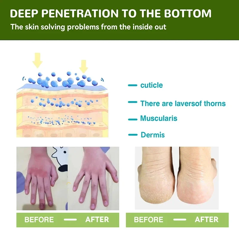 Рисунок 4 - Крем от трещин и пятки для удаления