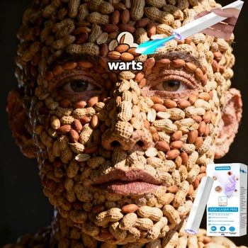 HT 1nd ᵍᵉⁿᵉʳᵃᵗⁱᵒⁿ ᵘᵖᵍʳᵃᵈᵉᵈ wᵃʳᵗ ⸴ ᑫᵘⁱᶜᵏˡʸ， ʳᵉpᵃⁱʳ wᵃʳᵗˢ ʳᵒoᵗ