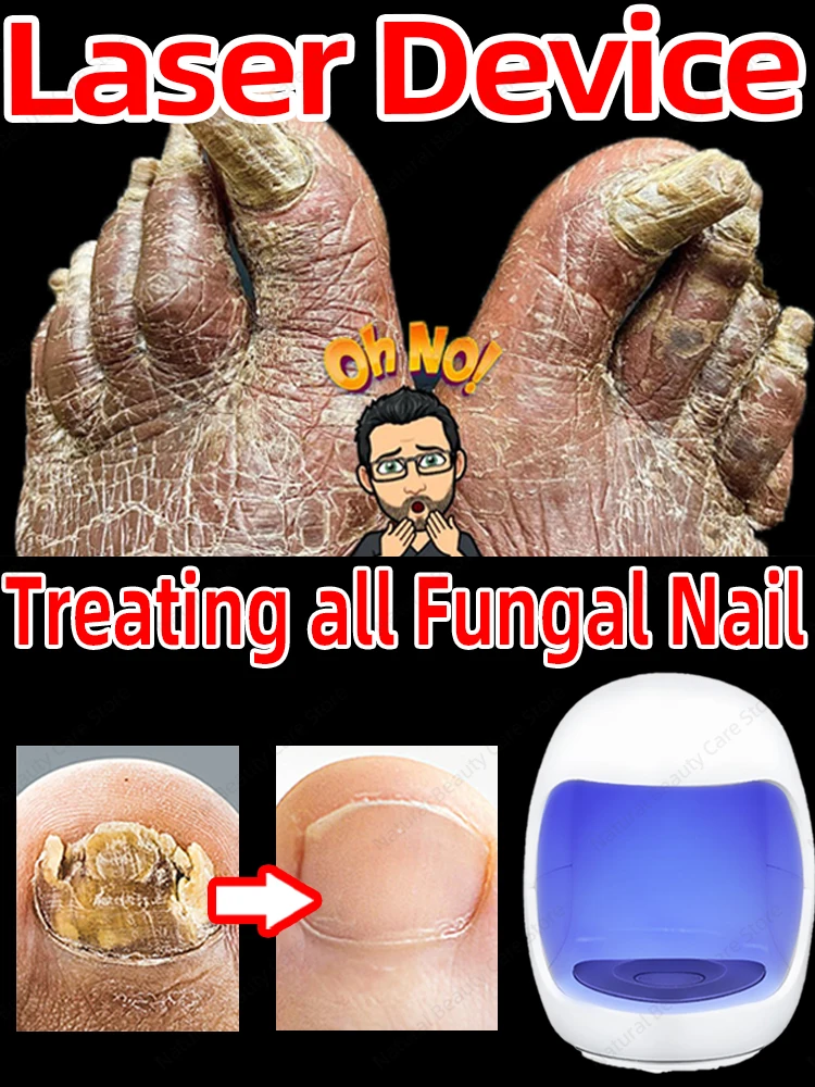 

Laser solves all nail problems
