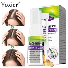 

Intensive Growth Serum Spray Promote Hair Regrowth Anti Hair Loss Treatment Ginger Prevent Baldness Damaged Germinal Liquid