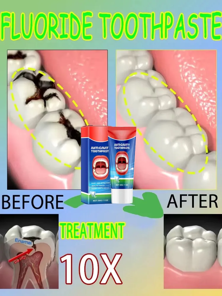 Teeth Health Product Tooth Decay Repair Cleans Plaque Whitens Teeth